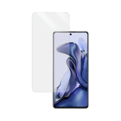 Película Hidrogel Hd Para Xiaomi 11t