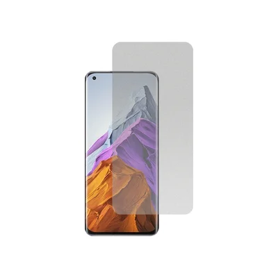 Película Hidrogel Fosca Para Xiaomi Mi 11 Pro