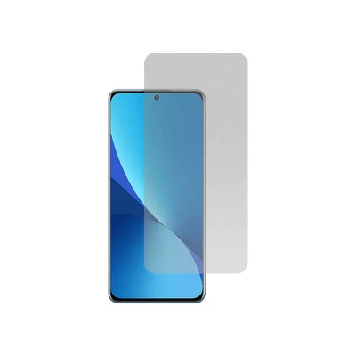 Película Hidrogel Fosca Para Xiaomi 12x
