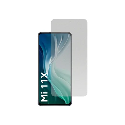 Película Hidrogel Fosca Para Xiaomi Mi 11x