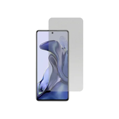 Película Hidrogel Fosca Para Xiaomi 11t